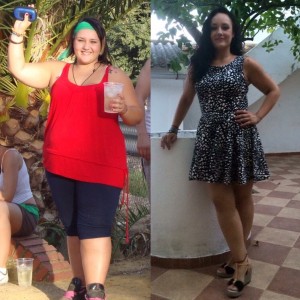 Antes y después - operación reducción peso